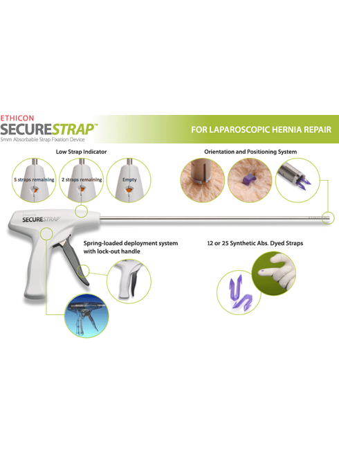 Эндоскопическое устройство для фиксации хирургических сеток SecureStrap (герниостеплер) при лапароскопических операциях